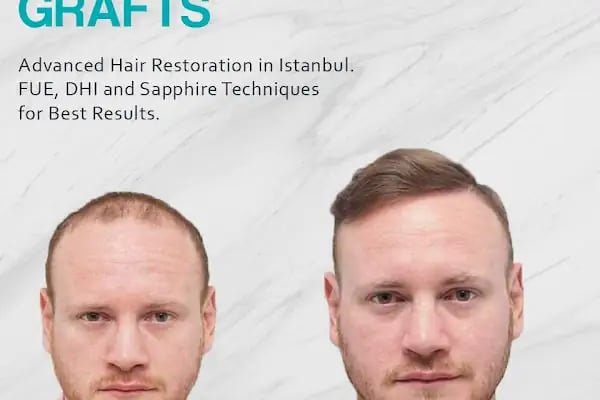 ALD Hair Clinic - Resim 7
