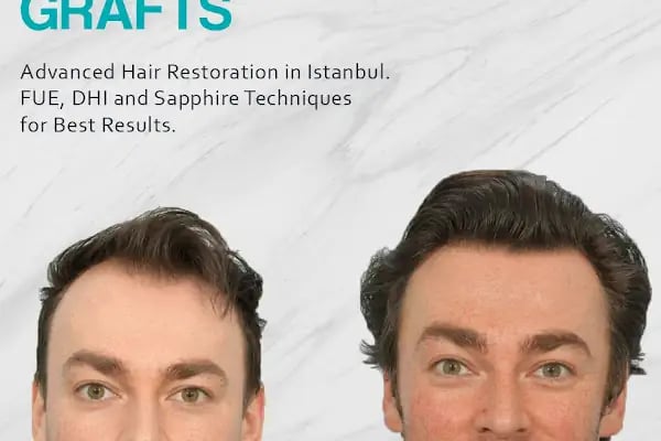 ALD Hair Clinic - Resim 11