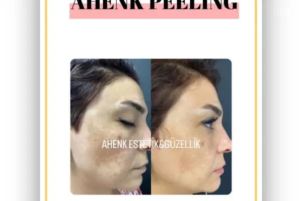 Ahenk Güzellik Avcılar - Resim 17