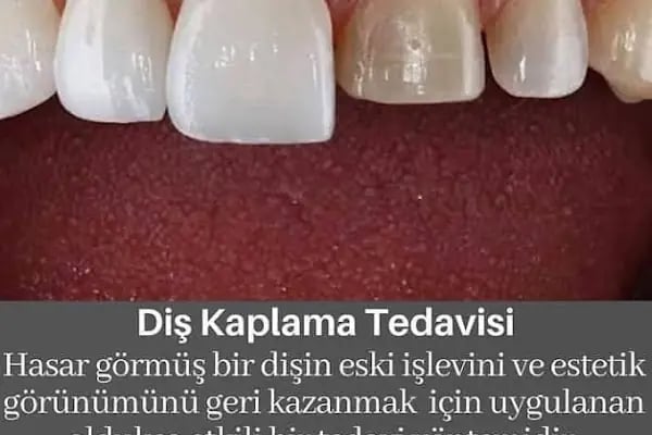 Elzem dent ağız ve diş sağlığı polikliniği - Resim 20