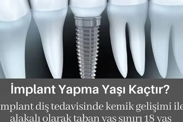 Elzem dent ağız ve diş sağlığı polikliniği - Resim 12