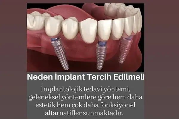 Elzem dent ağız ve diş sağlığı polikliniği - Resim 9