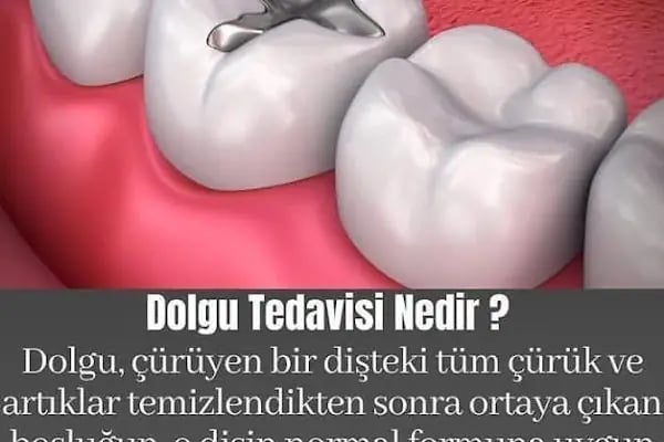Elzem dent ağız ve diş sağlığı polikliniği - Resim 15