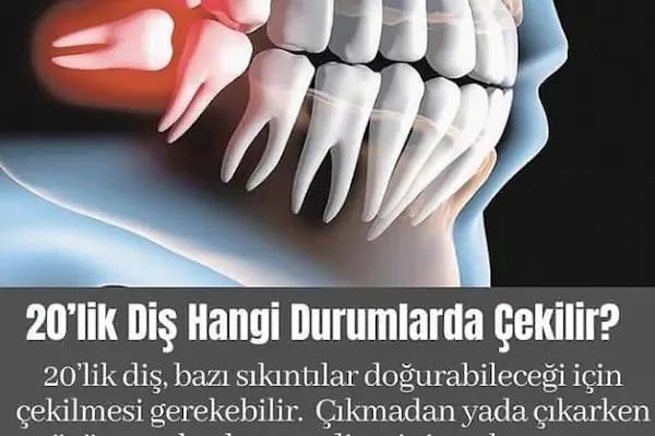 Elzem dent ağız ve diş sağlığı polikliniği - Resim 19