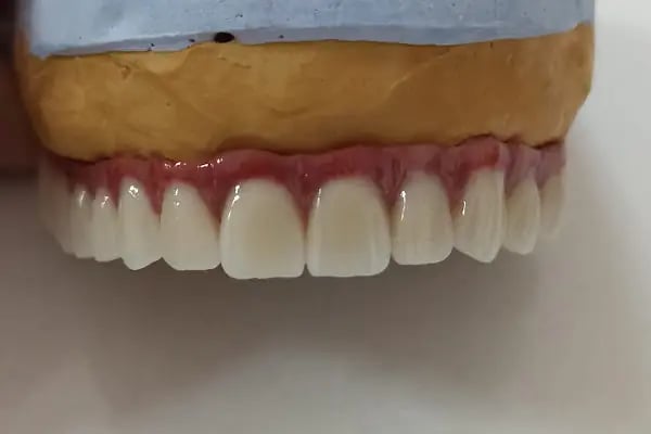 Elzem dent ağız ve diş sağlığı polikliniği - Resim 3