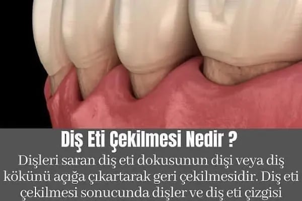 Elzem dent ağız ve diş sağlığı polikliniği - Resim 17