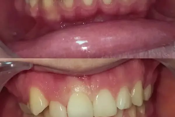 Elzem dent ağız ve diş sağlığı polikliniği - Resim 10