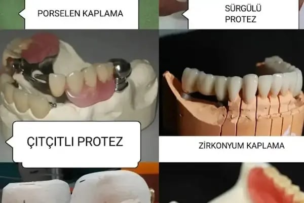 Elzem dent ağız ve diş sağlığı polikliniği - Resim 8