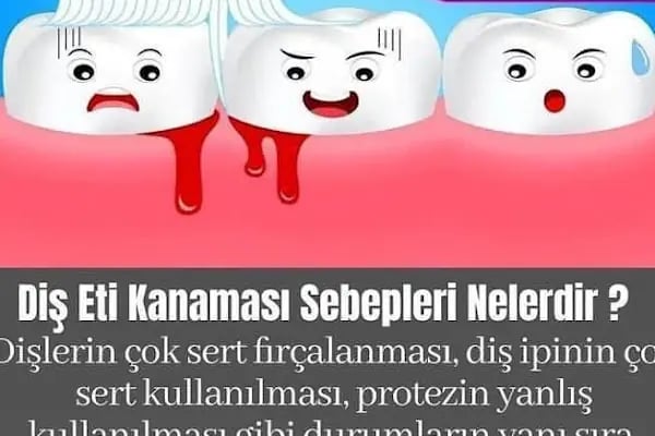 Elzem dent ağız ve diş sağlığı polikliniği - Resim 18