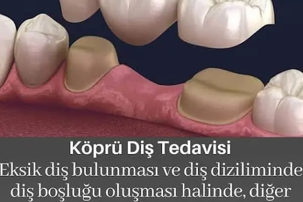 Elzem dent ağız ve diş sağlığı polikliniği - Resim 13
