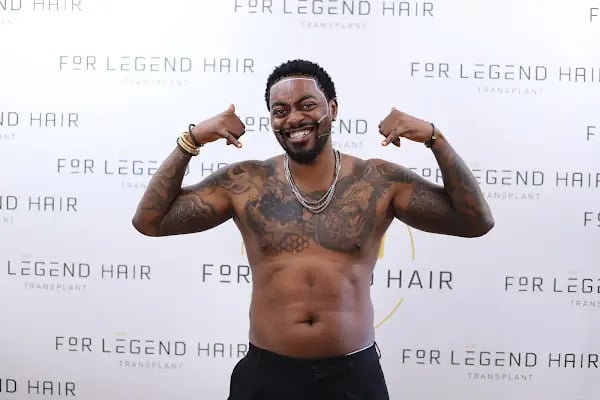 For Legend Hair Transplant - Resim 13