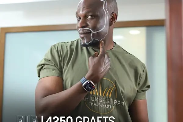 For Legend Hair Transplant - Resim 10