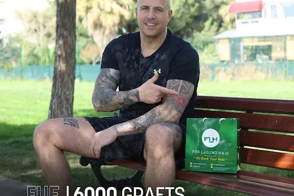 For Legend Hair Transplant - Resim 11