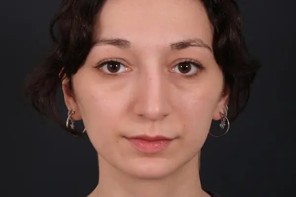 Op. Dr. Barış İlke Çokay - Resim 14