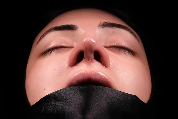 Op. Dr. Barış İlke Çokay - Resim 17