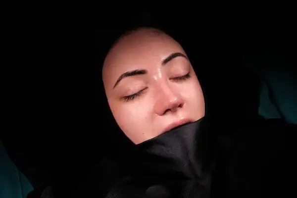 Op. Dr. Barış İlke Çokay - Resim 11