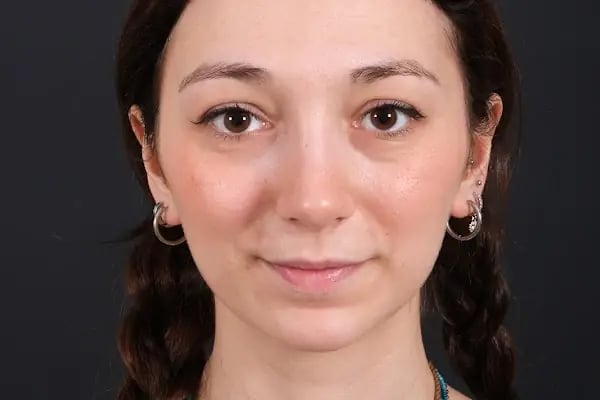 Op. Dr. Barış İlke Çokay - Resim 4