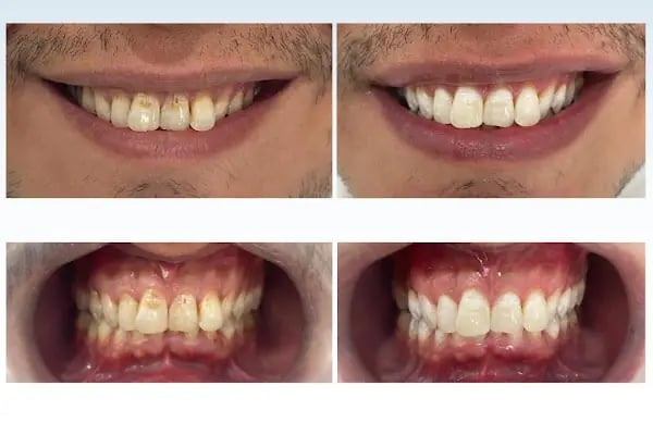 Konyagöz Ağız ve Diş Sağlığı Polikliniği - Resim 8