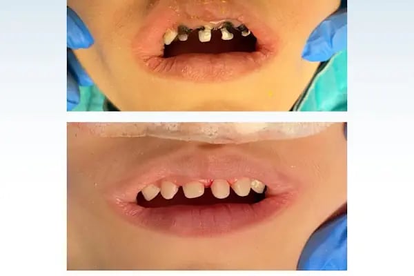 Konyagöz Ağız ve Diş Sağlığı Polikliniği - Resim 5