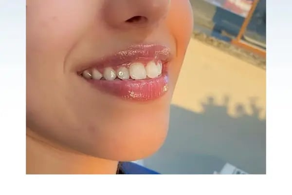 Konyagöz Ağız ve Diş Sağlığı Polikliniği - Resim 6