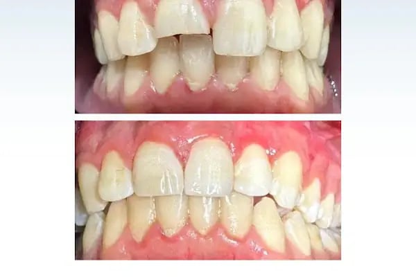 Konyagöz Ağız ve Diş Sağlığı Polikliniği - Resim 10
