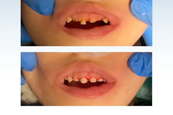 Konyagöz Ağız ve Diş Sağlığı Polikliniği - Resim 9