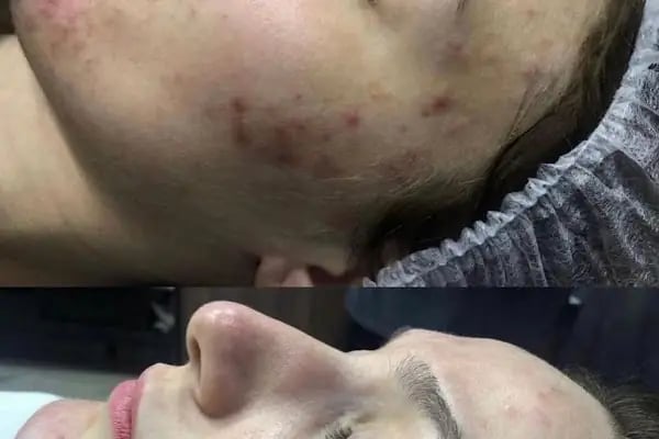 Aris Ezgi Doğan Güneşli VIP Güzellik Merkezi - Resim 13