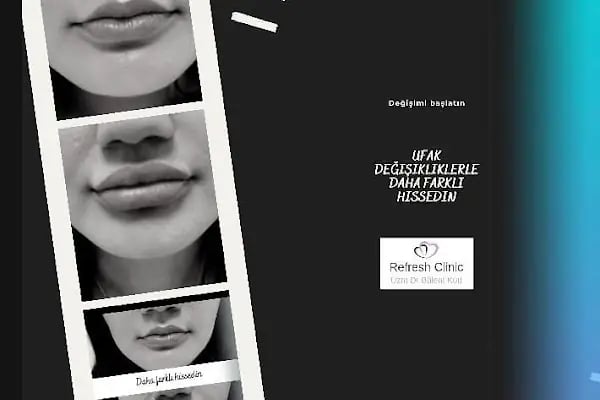 Dr Bülent Kurt Clinic - Resim 18