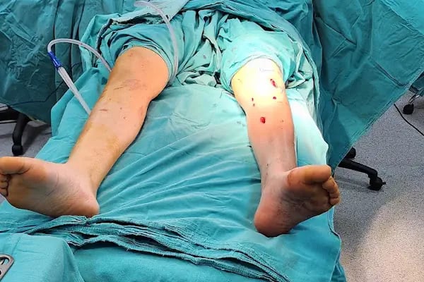 Prof. Dr. Bülent Dağlar Ortopedi ve Travmatoloji Uzmanı - Resim 10