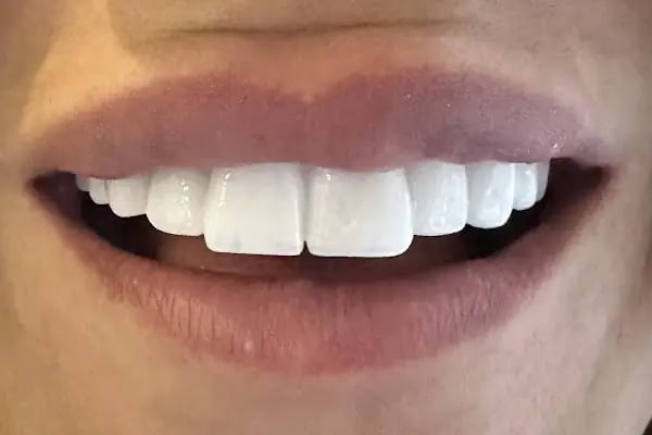 ACE Klinik Ağız ve Diş Sağlığı Polikliniği - Resim 15