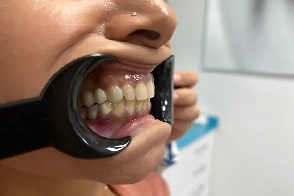 Ahsen Ağız ve Diş Sağlığı Polikliniği - Resim 15