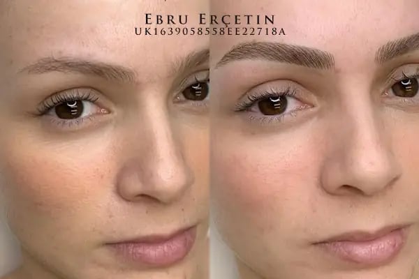 Beauty Proff Güzellik Merkezi - Resim 19
