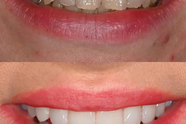 Dent Karya Ağız-Diş Sağlığı Polikliniği - Resim 5