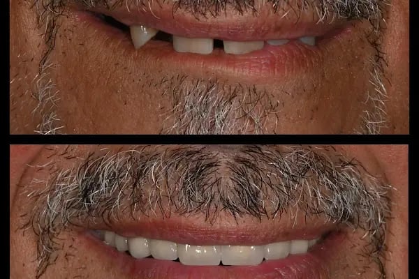 Dent Karya Ağız-Diş Sağlığı Polikliniği - Resim 9