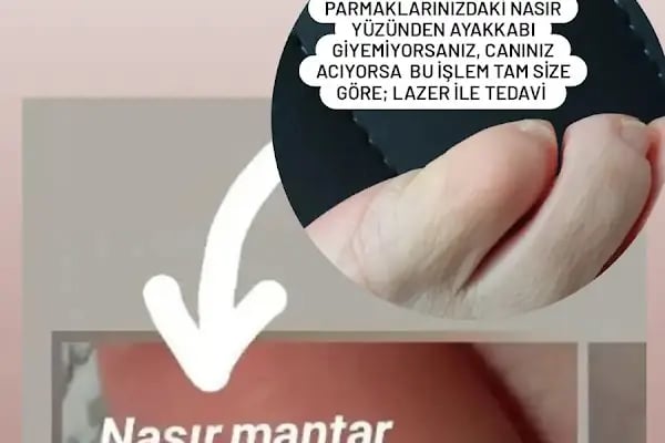 Avva Estetik ve Güzellik Merkezi - Resim 8