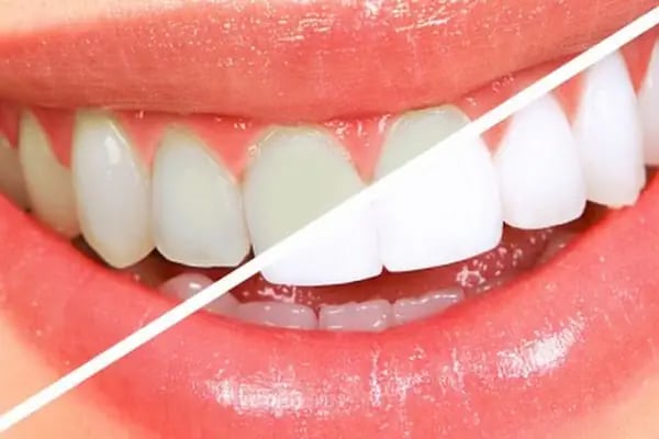 Dentagora Ağız ve Diş Sağlığı Polikliniği Bayraklı Şubesi - Resim 7