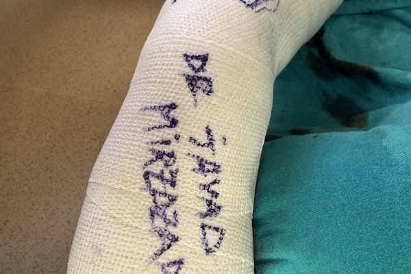 Op. Dr. Javad Mirzazada, Ortopedi Ve Travmatoloji - Resim 7
