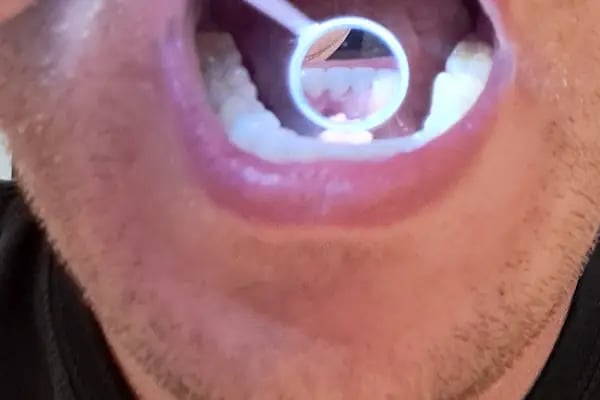 Kaplan DentAlanya Ağız ve Diş Sağlığı Polikliniği - Resim 8