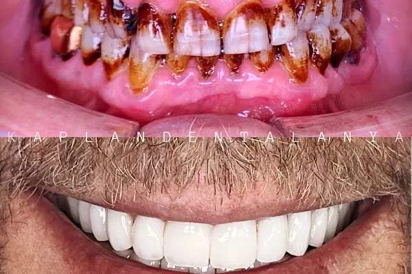 Kaplan DentAlanya Ağız ve Diş Sağlığı Polikliniği - Resim 2