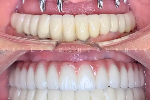Kaplan DentAlanya Ağız ve Diş Sağlığı Polikliniği - Resim 1