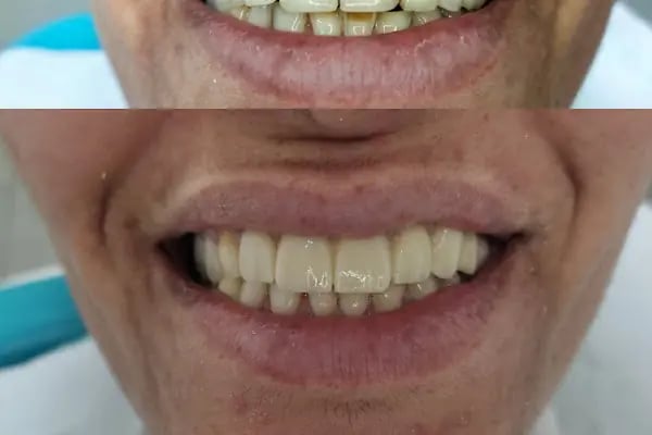 Alfa Ağız ve Diş Sağlığı Polikliniği - Resim 10
