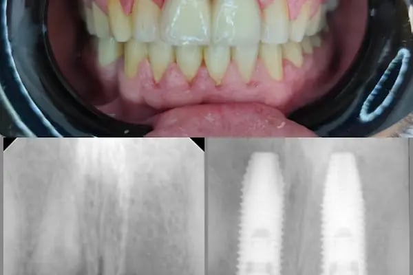 Alfa Ağız ve Diş Sağlığı Polikliniği - Resim 12
