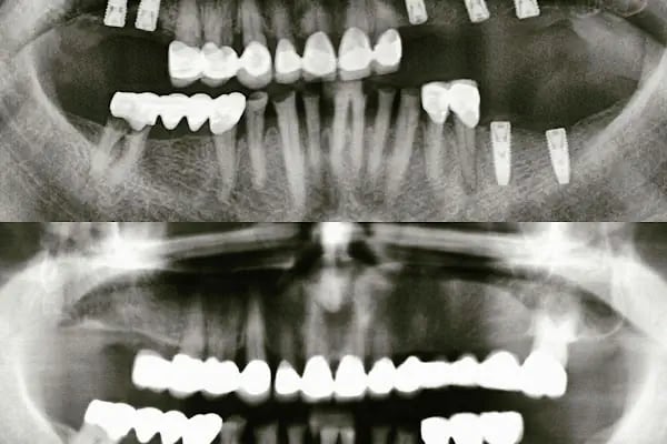 Alfa Ağız ve Diş Sağlığı Polikliniği - Resim 6