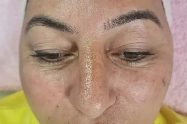 Nur Şimşek Beauty Center - Resim 14