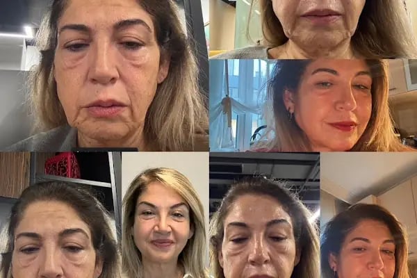 Dr. Ayhan Dağaşan - Resim 7