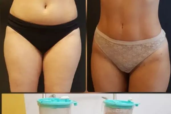Op. Dr. Hüseyin ZEYBEK - Estetik, Plastik ve Rekonstrüktif Cerrahi - Resim 4