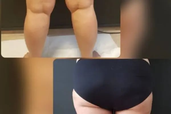 Op. Dr. Hüseyin ZEYBEK - Estetik, Plastik ve Rekonstrüktif Cerrahi - Resim 5
