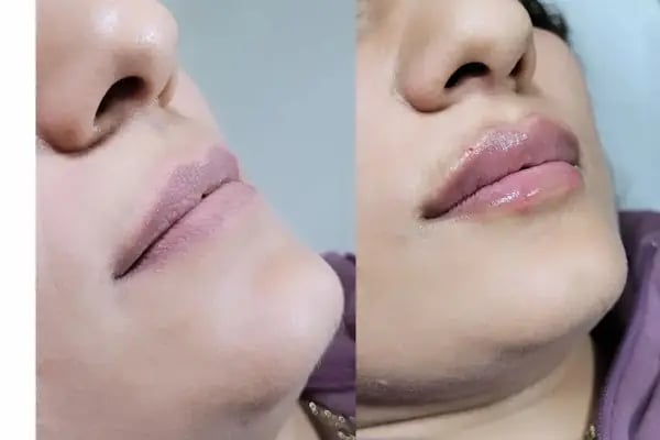 5A ESTETİK SAĞLIK MEDİKAL - Resim 6