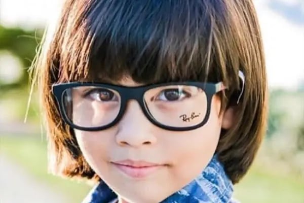 Fad Optik Lens - Resim 7