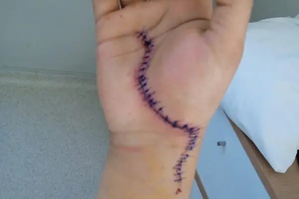 Ankara El Cerrahisi, Op.Dr.İbrahim Kasapoğlu - Resim 9